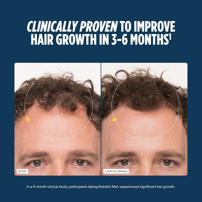 Nutrafol Men Hair Growth Supplements Ages 18-49 for Thinning Hair Clinically Tested for Visibly Thicker Hair and Scalp Coverage Dermatologist Recommended
